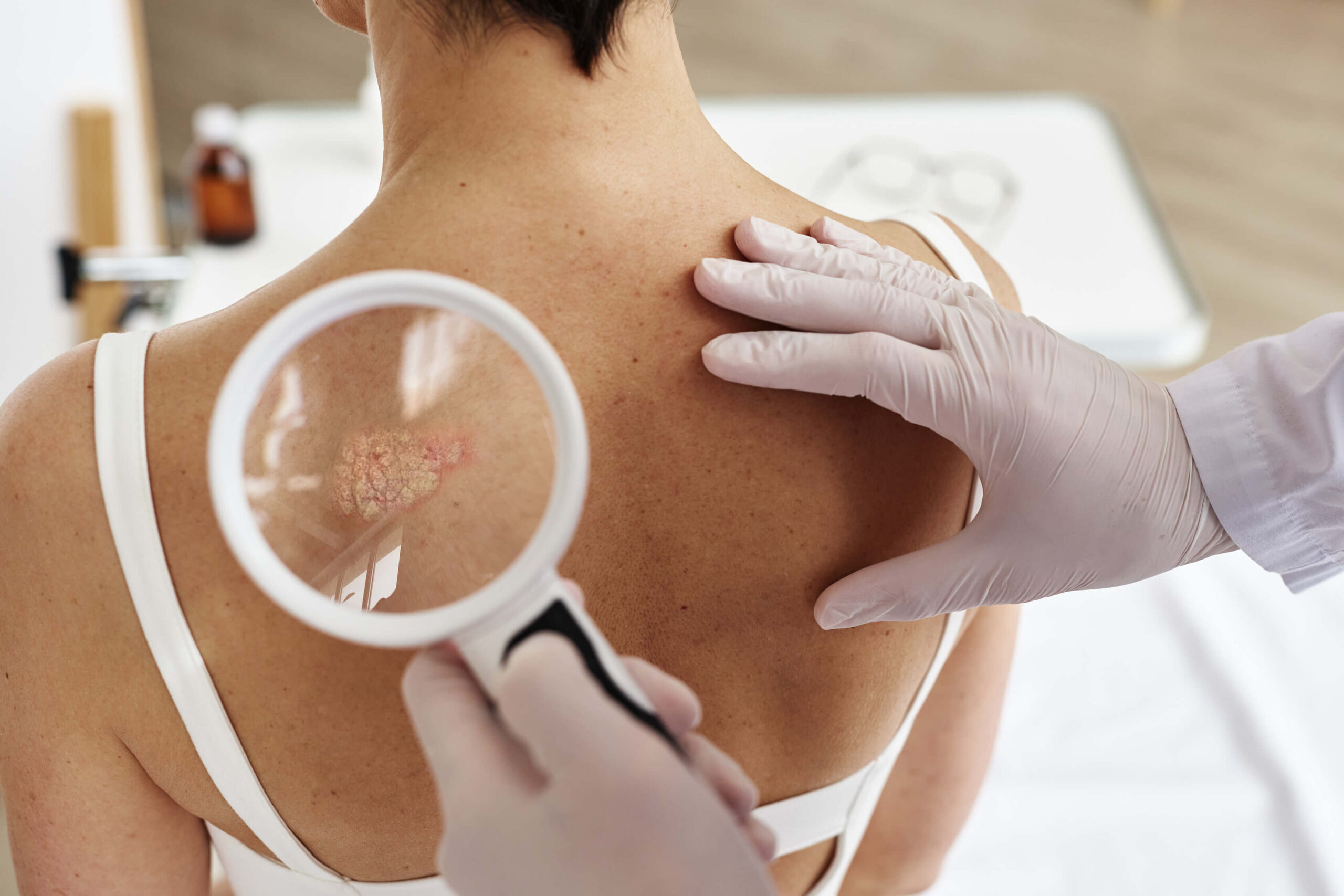dermatologiya